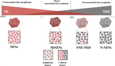 Gastric mixed neuroendocrine non-neuroendocrine neoplasms